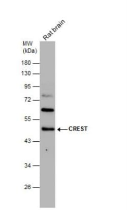 SS18L1 Antibody, Novus Biologicals 0.1mL; Unlabeled:Antibodies, Polyclonal