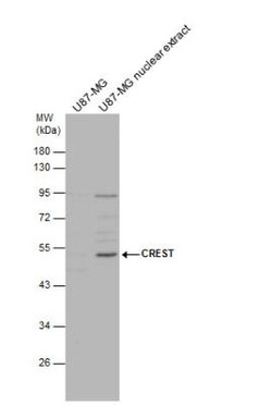 SS18L1 Antibody, Novus Biologicals 0.1mL; Unlabeled:Antibodies, Polyclonal