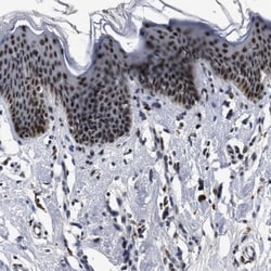 SSBIP1/SOSS-C Antibody, Novus Biologicals:Antibodies:Primary Antibodies