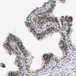 SSBIP1/SOSS-C Antibody, Novus Biologicals:Antibodies:Primary Antibodies