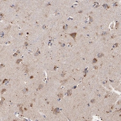 SSBP1 Antibody, Novus Biologicals 0.1mL; Unlabeled:Antibodies, Polyclonal