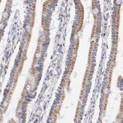 SSBP1 Antibody, Novus Biologicals 0.1mL; Unlabeled:Antibodies, Polyclonal