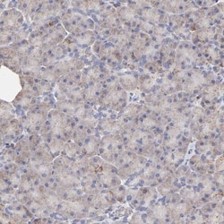 SSBP1 Antibody, Novus Biologicals 0.1mL; Unlabeled:Antibodies, Polyclonal