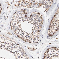 SSBP1 Antibody, Novus Biologicals 0.1mL; Unlabeled:Antibodies, Polyclonal