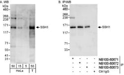 SSH1 Antibody, Novus Biologicals 0.1mL; Unlabeled:Antibodies, Polyclonal