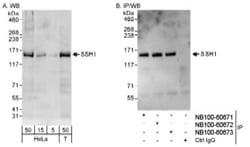 SSH1 Antibody, Novus Biologicals 0.1mL; Unlabeled:Antibodies, Polyclonal