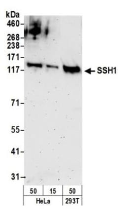SSH1 Antibody, Novus Biologicals 0.1mL; Unlabeled:Antibodies, Polyclonal