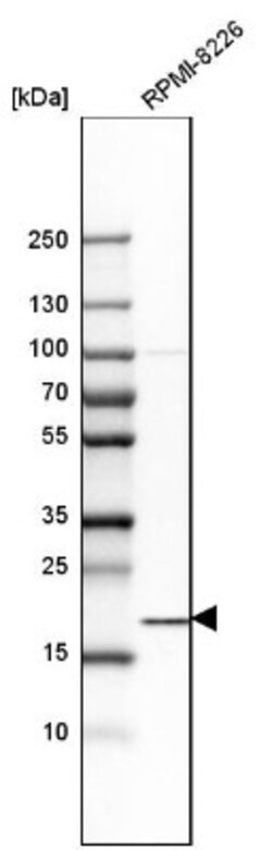 SSR3 Antibody, Novus Biologicals 0.1mL; Unlabeled:Antibodies, Polyclonal