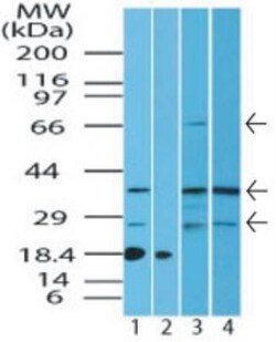 anti-ST2/IL-1 R4, Polyclonal, Novus Biologicals