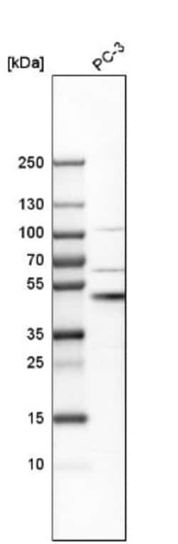 ST3 beta-Gal alpha-2,3-Sialyltransferase 1/ST3GAL1/SIAT4A Antibody, Novus