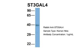 ST3GAL4 Antibody, Novus Biologicals:Antibodies:Primary Antibodies