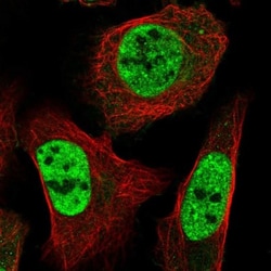 ST5 Antibody, Novus Biologicals 0.1mL; Unlabeled:Antibodies, Polyclonal