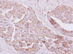 ST6 Sialyltransferase 2/ST6GALNAC2 Antibody, Novus Biologicals 0.1mL; Unlabeled:Antibodies,