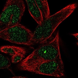 ST6 Sialyltransferase 6/ST6GALNAC6 Antibody, Novus Biologicals 0.1mL; Unlabeled:Antibodies,