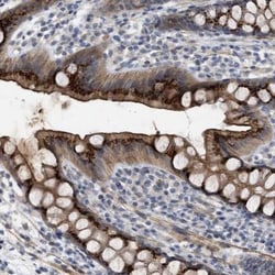 ST6 Sialyltransferase 6/ST6GALNAC6 Antibody, Novus Biologicals 0.1mL; Unlabeled:Antibodies,