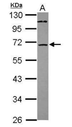 ST6GALNAC1 Antibody, Novus Biologicals 0.1mL; Unlabeled:Antibodies, Polyclonal
