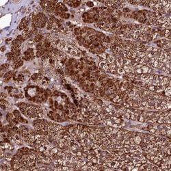 Suppression of Tumorigenicity 7 Antibody, Novus Biologicals 0.1mL; Unlabeled:Antibodies,
