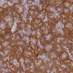 ST7L Antibody, Novus Biologicals 0.1mL; Unlabeled:Antibodies, Polyclonal