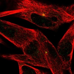 ST8 alpha-2,8-Sialyltransferase 8B/ST8SIA2 Antibody, Novus Biologicals:Antibodies:Primary