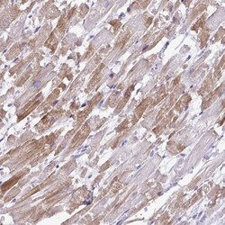 ST8 alpha-2,8-Sialyltransferase 8B/ST8SIA2 Antibody, Novus Biologicals:Antibodies:Primary
