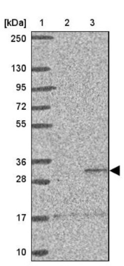 ST8 alpha-2,8-Sialyltransferase 8B/ST8SIA2 Antibody, Novus Biologicals:Antibodies:Primary