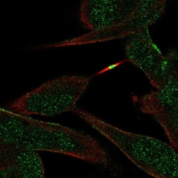 ST8SIA5 Antibody, Novus Biologicals:Antibodies:Primary Antibodies