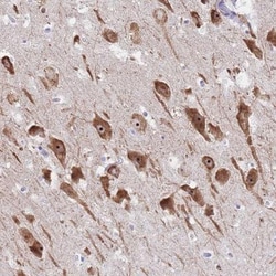 ST8SIA5 Antibody, Novus Biologicals:Antibodies:Primary Antibodies