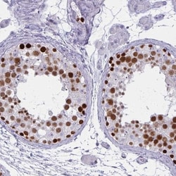 STAG3 Antibody, Novus Biologicals 0.1mL; Unlabeled:Antibodies, Polyclonal