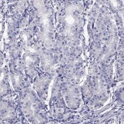 STAG3 Antibody, Novus Biologicals 0.1mL; Unlabeled:Antibodies, Polyclonal