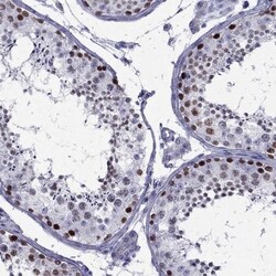STAG3 Antibody, Novus Biologicals 0.1mL; Unlabeled:Antibodies, Polyclonal