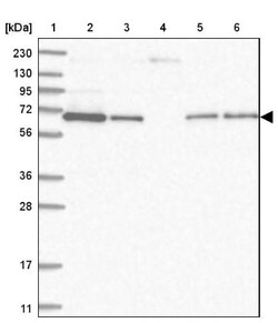 STAM2 Antibody, Novus Biologicals 25 &mu;L; Unlabeled:Antibodies, Polyclonal