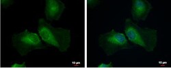 AMSH-LP Antibody, Novus Biologicals 0.1 mL | Buy Online | Novus Biologicals | Fisher Scientific