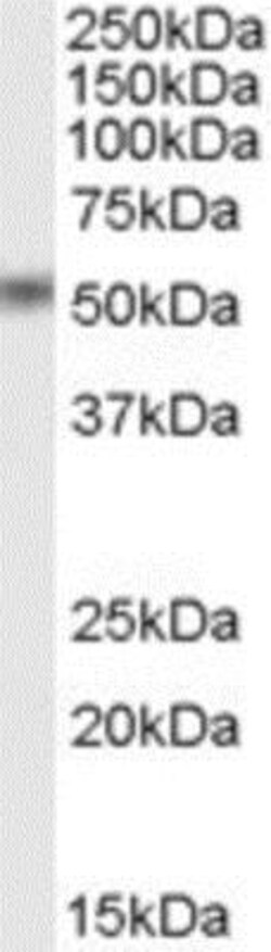 STAMP2/STEAP4 Antibody, Novus Biologicals 0.1mg; Unlabeled:Antibodies,
