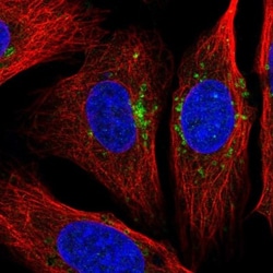 STARD3NL Antibody, Novus Biologicals 0.1mL; Unlabeled:Antibodies, Polyclonal