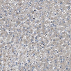 STARD3NL Antibody, Novus Biologicals 0.1mL; Unlabeled:Antibodies, Polyclonal