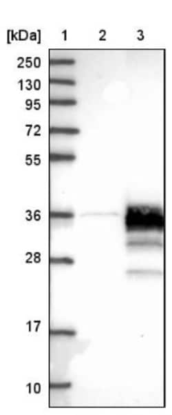 STARD3NL Antibody, Novus Biologicals 0.1mL; Unlabeled:Antibodies, Polyclonal