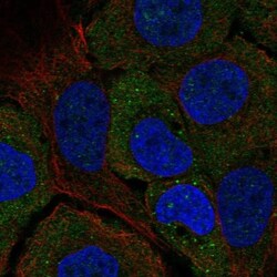 STARD5 Antibody, Novus Biologicals 25 &mu;L, Unlabeled:Antibodies, Polyclonal
