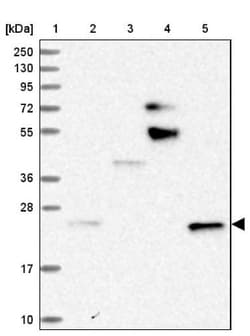 STARD5 Antibody, Novus Biologicals 25 &mu;L, Unlabeled:Antibodies, Polyclonal