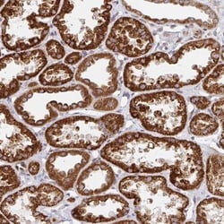STARD8 Antibody, Novus Biologicals:Antibodies:Primary Antibodies