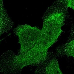 STAT6 Antibody, Novus Biologicals 0.1mL; Unlabeled:Antibodies, Polyclonal