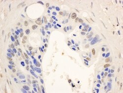 STAT6 Antibody, Novus Biologicals 0.1mg; Unlabeled:Antibodies, Polyclonal