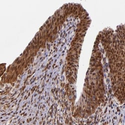 STAT6 Antibody, Novus Biologicals 0.1mL; Unlabeled:Antibodies, Polyclonal