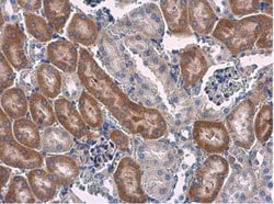STAT6 Antibody, Novus Biologicals 0.1mL; Unlabeled:Antibodies, Polyclonal