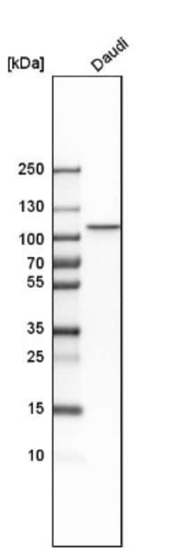 STAT6 Antibody, Novus Biologicals 0.1mL; Unlabeled:Antibodies, Polyclonal