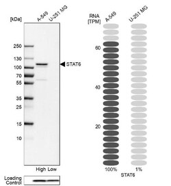 STAT6 Antibody, Novus Biologicals 0.1mL; Unlabeled:Antibodies, Polyclonal