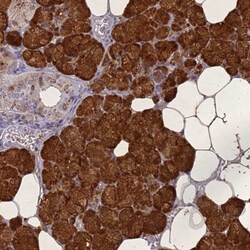 STATH Antibody, Novus Biologicals 25 &mu;L, Unlabeled:Antibodies, Polyclonal