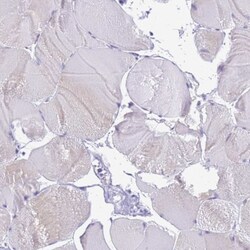 STATH Antibody, Novus Biologicals 25 &mu;L, Unlabeled:Antibodies, Polyclonal