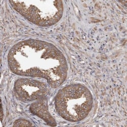STEAP2 Antibody, Novus Biologicals 0.1mL; Unlabeled:Antibodies, Polyclonal