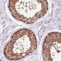 STI1 Antibody, Novus Biologicals:Antibodies:Primary Antibodies