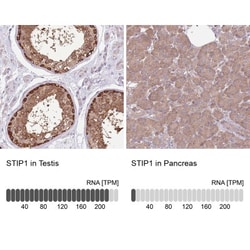 STI1 Antibody, Novus Biologicals:Antibodies:Primary Antibodies